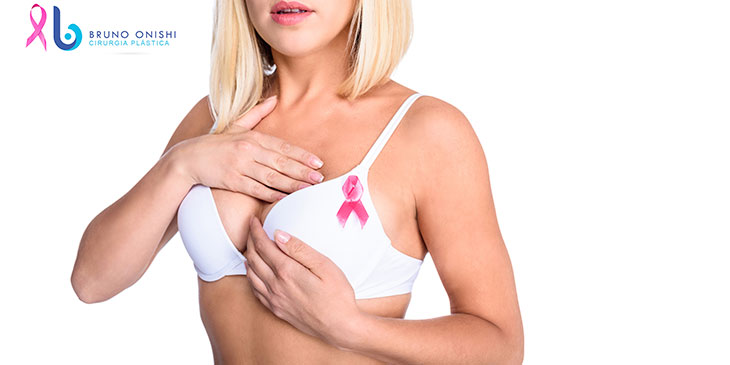 Câncer de mama, mastectomia e a importância das campanhas de conscientização