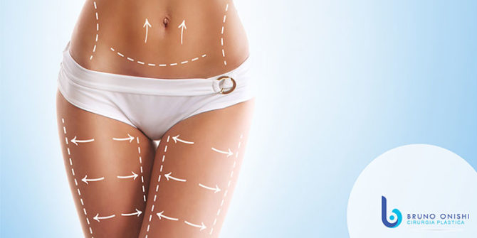 Como eliminar a flacidez? Conheça os possíveis tratamentos